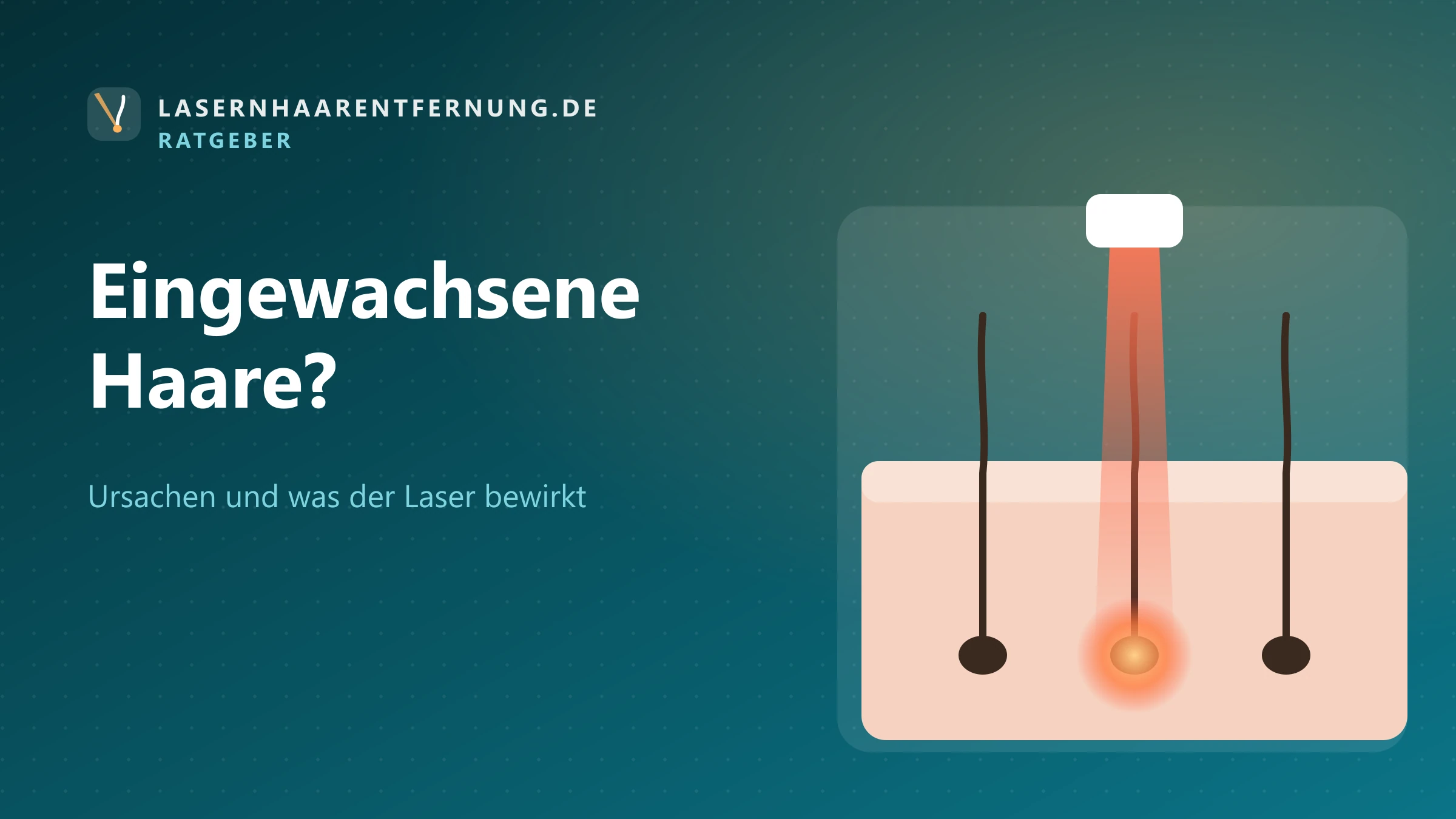 Illustration: Haarfollikel unter der Haut
