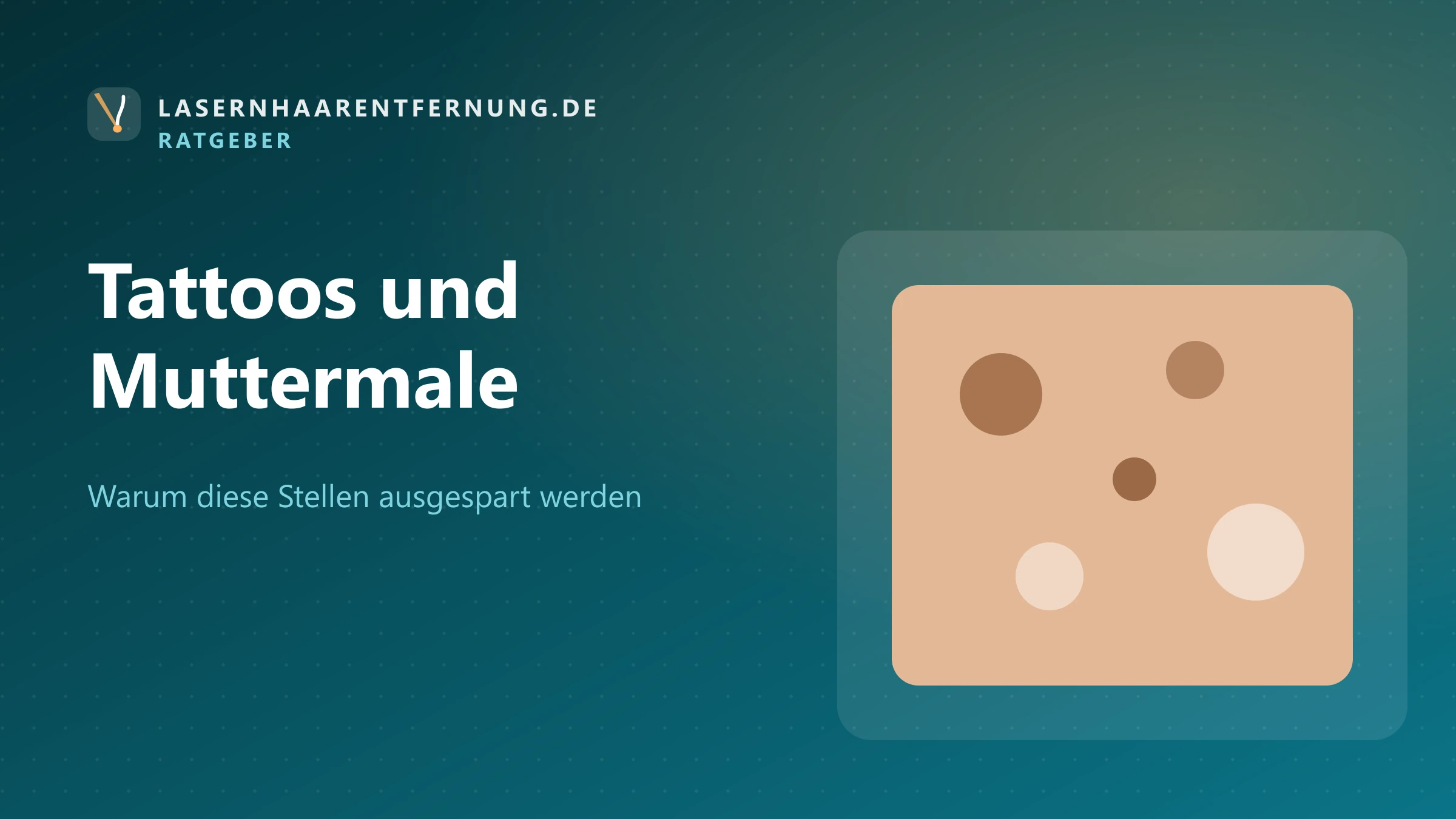 Illustration: Hautausschnitt mit Muttermalen und Pigmentflecken