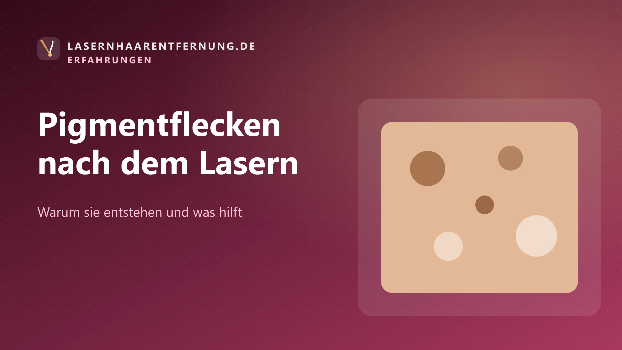 Illustration: Hautfarben und Pigmentveränderungen